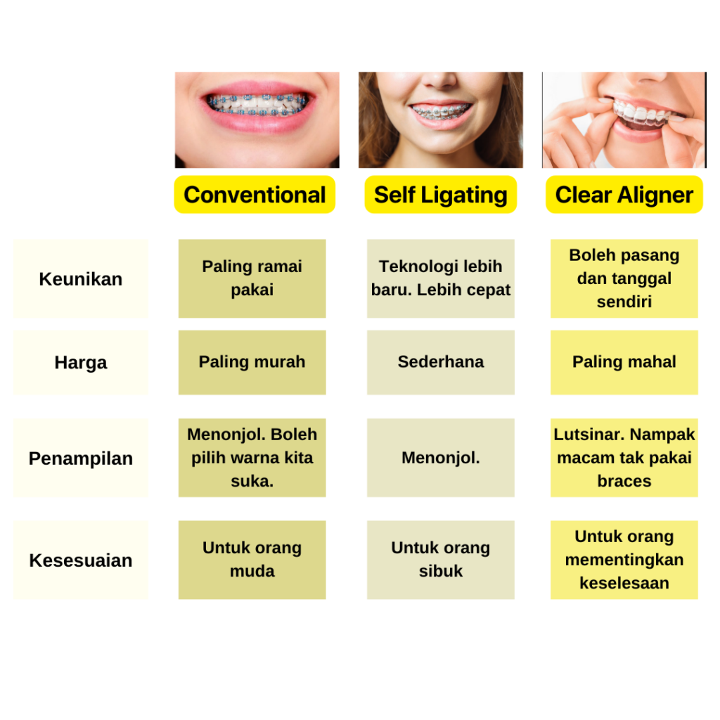 perbandingan braces